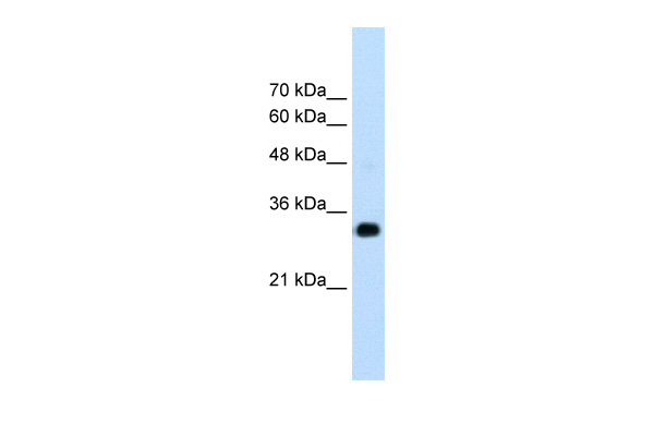 RNF121 antibody - N-terminal region (ARP43252_T100) in Human HepG2 using Western Blot