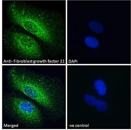 FGF21 antibody, Internal
