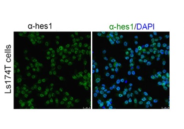 HES1 antibody - N-terminal region (ARP32372_T100) in Human Ls174T using Immunofluorescence