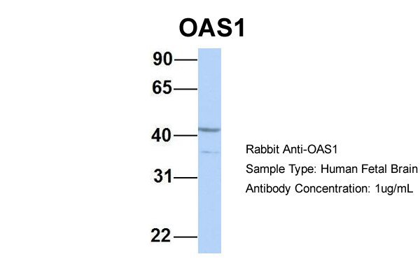 OAS1 antibody - C-terminal region (ARP30587_P050) in Hum. Fetal Brain using Western Blot