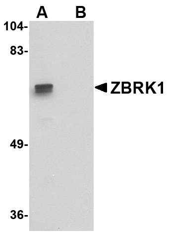ZBRK1 Antibody (OAPB00760) in A-20 using Western Blot