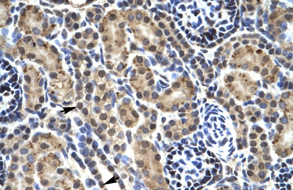 PHKG2 antibody - N-terminal region (ARP33072_P050) in Human kidney using Immunohistochemistry