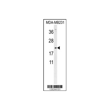 DMRTC1 antibody - N-terminal region (OAAB00583) in MDA-MB231 using Western Blot