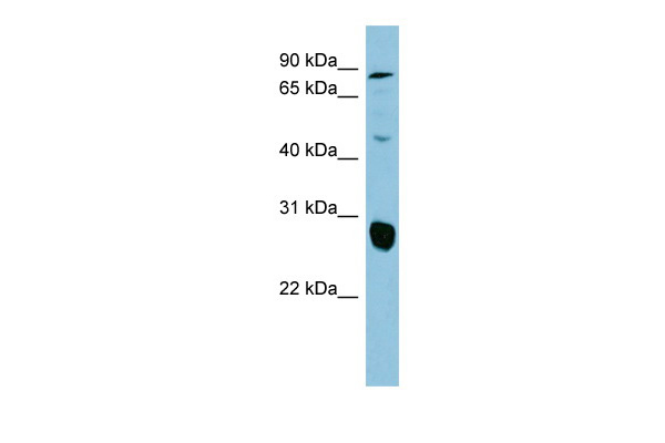 SLC26A4 antibody - middle region (ARP41739_P050) in Human COLO205 using Western Blot
