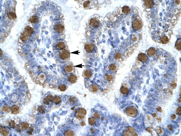 CDK7 antibody - C-terminal region (AVARP03009_P050) in Human Intestine using Immunohistochemistry