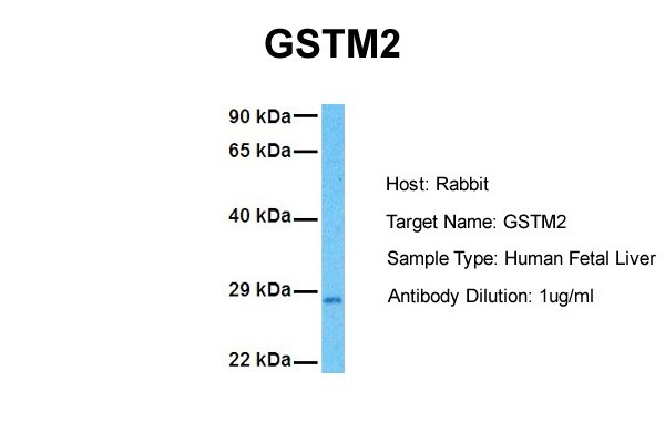 GSTM2 antibody - N-terminal region (ARP41818_P050) in Human Fetal Liver using Western Blot