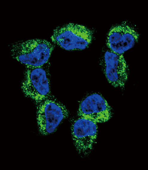 BDNF antibody - C-terminal region (OAAB05026) in NCI-H460 using Immunofluorescence