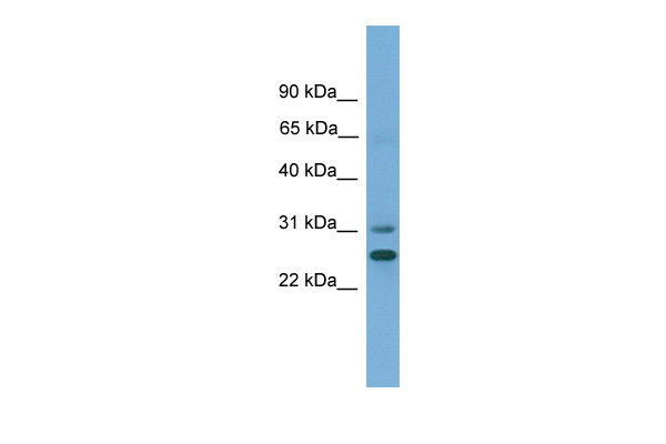 DHRS2 antibody - N-terminal region (ARP42258_P050) in Human HT1080 using Western Blot