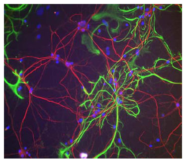 Anti-Neurofilament H (NF-H) (OAPC00025) in Rat cortical neurons and glia using Immunofluorescence
