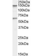 CARD11 Antibody (OAEB02396) in human Jurkatscells using Western Blot