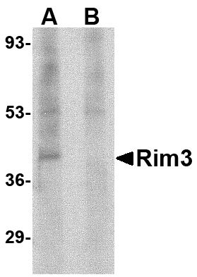 Rim3 Antibody (OAPB00629) in Human brain using Western Blot