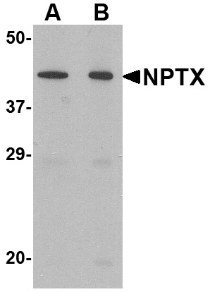 NPTX2 Antibody (OAPB00669) in mouse brain using Western Blot