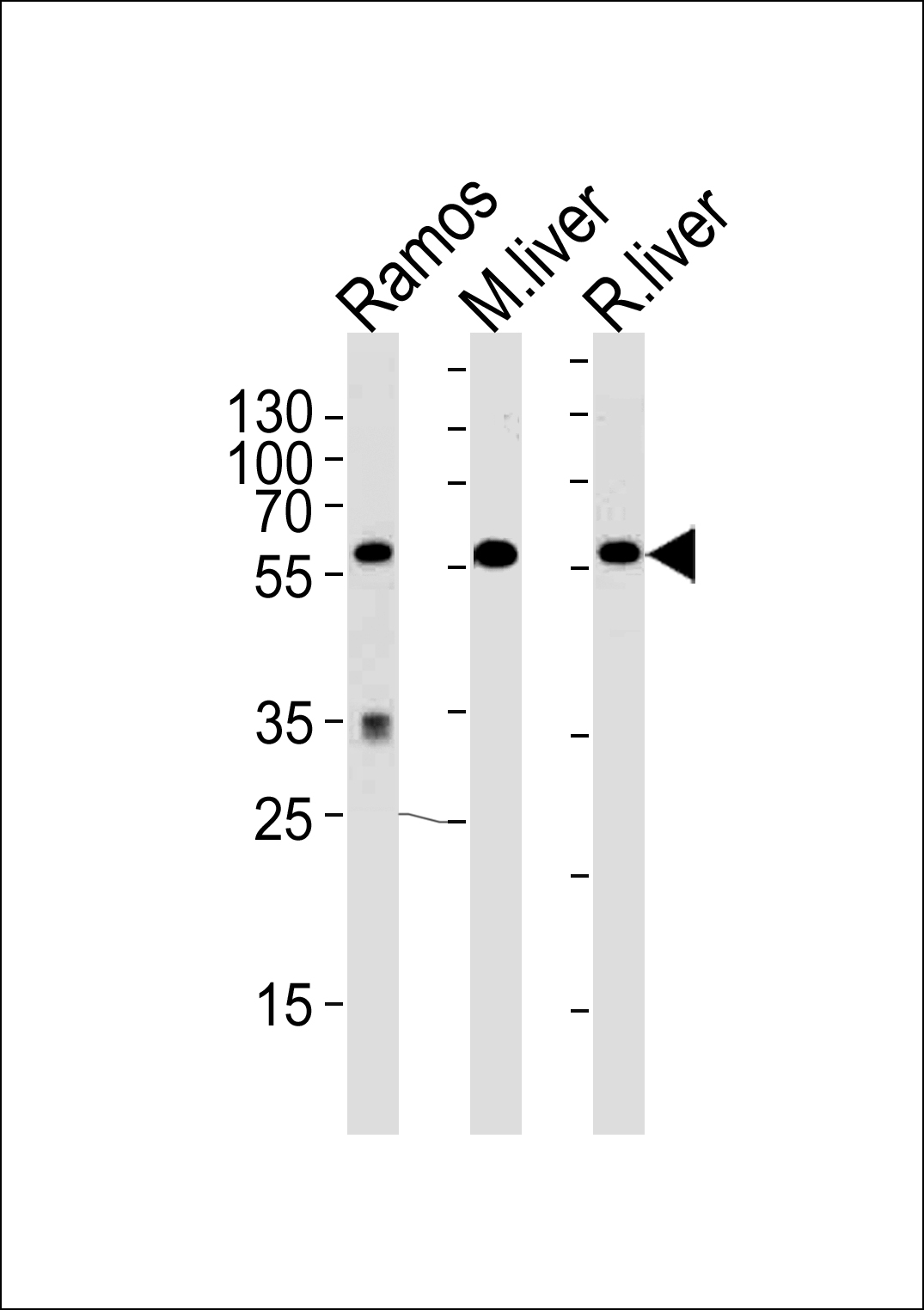 GPI antibody - C-terminal region (OAAB06387) in Ramos, Mouse Liver, Rat Liver using Western Blot