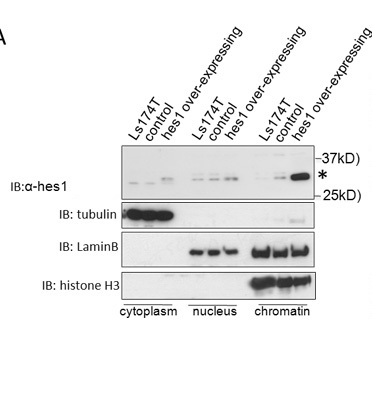 HES1 antibody - N-terminal region (ARP32372_T100) in Human Ls174T using Western Blot
