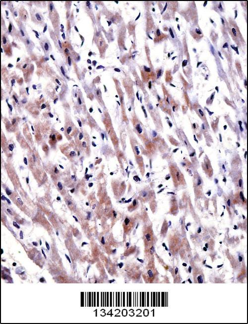 EGLN3 antibody - C - terminal region (OAAB10520) in Human Heart using Immunohistochemistry