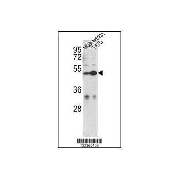 CEP55 antibody - N-terminal region (OAAB05178) in MDA-MB231, T47D using Western Blot