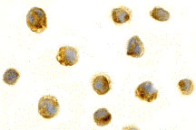 BAFF Antibody (0.1 mg) in HL60 using Immunocytochemistry.