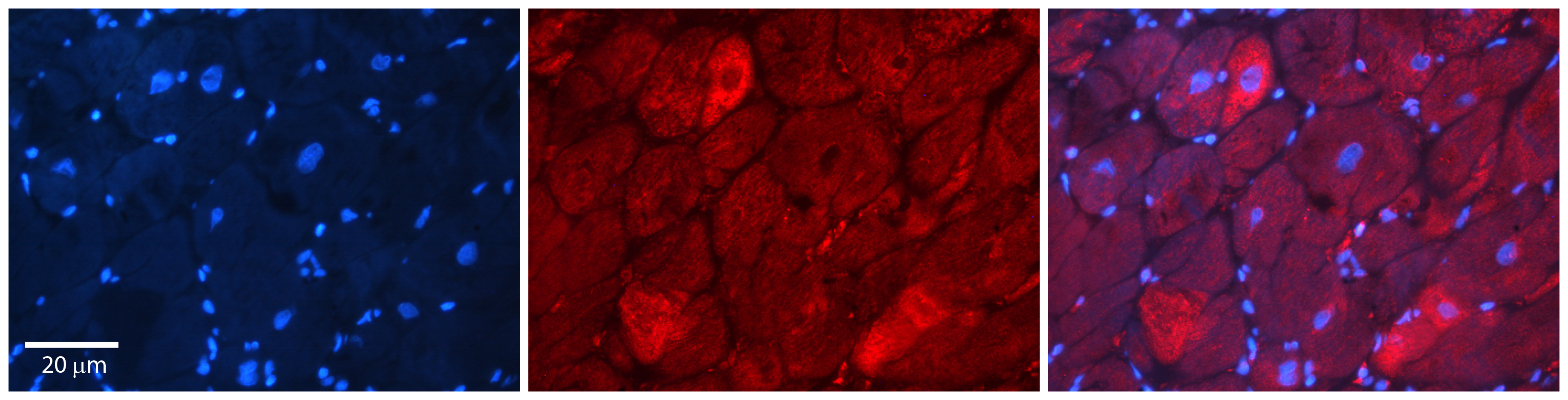 DAP antibody - middle region (ARP60156_P050) in human heart tissue using Immunohistochemistry