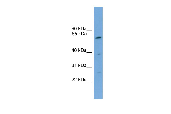 PSMD3 antibody - middle region (ARP56480_P050) in Human THP-1 using Western Blot