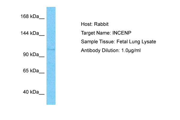 INCENP Antibody (ARP63541_P050) in Human Fetal Lung using Western Blot