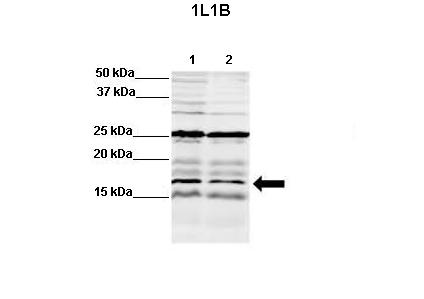 IL1B antibody - N-terminal region (ARP54323_P050) in rat,mouse brain extract using Western Blot