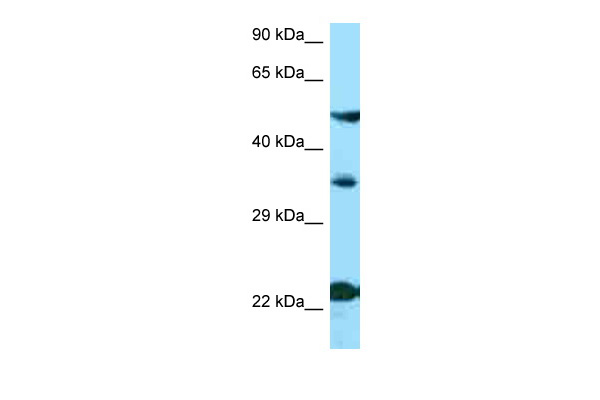 MC4R antibody - N-terminal region (ARP63247_P050) in Human ACHN using Western Blot