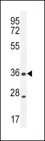 XCR1 antibody - C - terminal region (OAAB08286) in MDA-MB435 using Western Blot