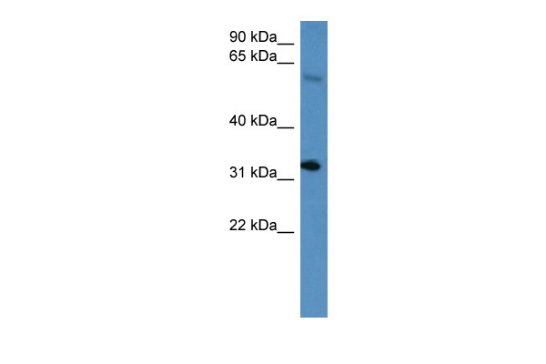 Hoxd13 antibody - C-terminal region (ARP31968_P050) in Mouse Spleen using Western Blot