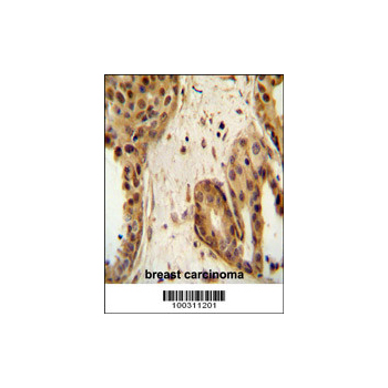 STAT2 antibody - C - terminal region (OAAB11364) in Human Breast using Immunohistochemistry