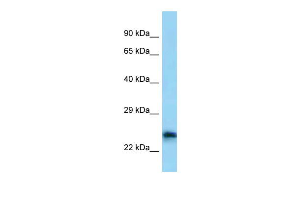 CALN1 antibody - C-terminal region (ARP62435_P050) in Human COLO205 using Western Blot