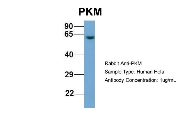 PKM2 antibody - middle region (ARP57789_P050) in Human Hela using Western Blot