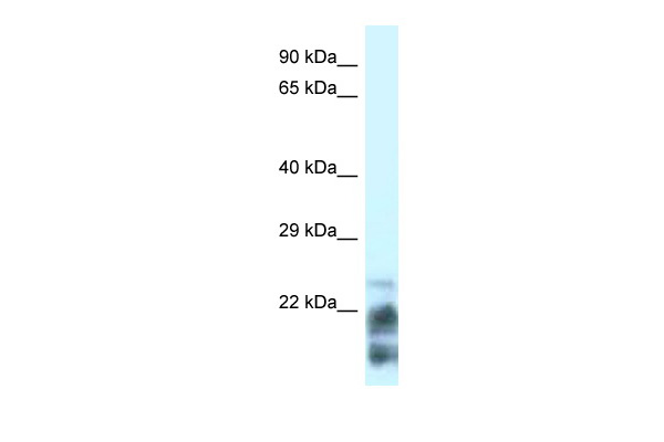 MDP-1 antibody - N-terminal region (ARP52625_P050) in Human HT1080 using Western Blot