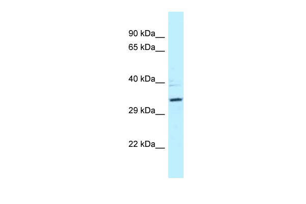 PPP2R4 antibody - N-terminal region (ARP62067_P050) in Human MDA-MB435 using Western Blot