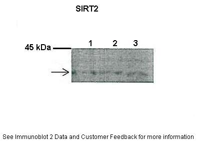SIRT2 antibody - C-terminal region (ARP32385_P050) in Mouse pancreas using Western Blot
