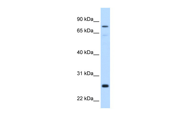 GSTM2 antibody - N-terminal region (ARP41818_P050) in Human Liver using Western Blot