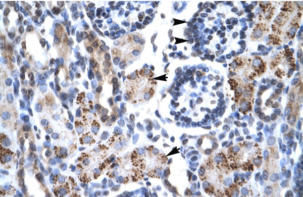 GFI1B antibody - N-terminal region (ARP30093_P050) in Human kidney using Immunohistochemistry