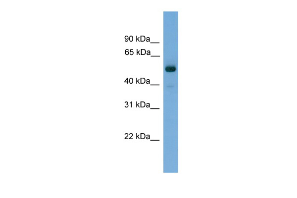 FSCN3 antibody - middle region (ARP53741_P050) in Human Muscle using Western Blot