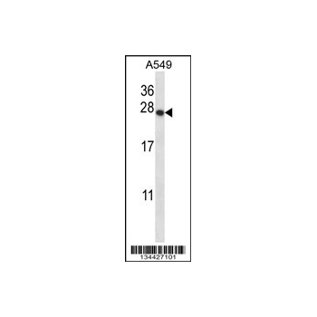 PSMD9 antibody - C - terminal region (OAAB10853) in A549 using Western Blot