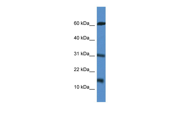 CARD17 antibody - middle region (ARP61219_P050) in Human Jurkat using Western Blot