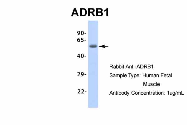 ADRB1 antibody - middle region (ARP36551_P050) in Hum. Fetal Muscle using Western Blot