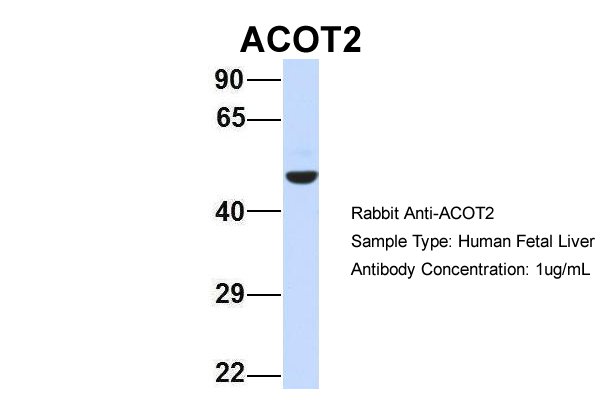 ACOT2 antibody - middle region (ARP42322_P050) in Hum. Fetal Liver using Western Blot