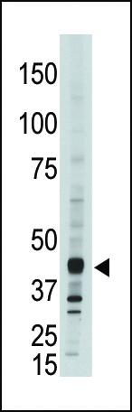 APOBEC3G (CEM15) antibody - C - terminal region (OAAB09817) in A375 using Western Blot