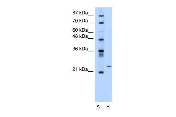PMF1 antibody - middle region (ARP33105_P050) in Transfected 293T using Western Blot