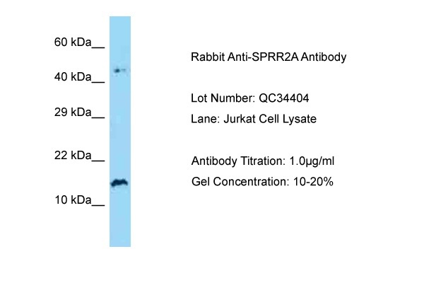 SPRR2A antibody - N-terminal region (ARP63530_P050) in Human Jurkat using Western Blot