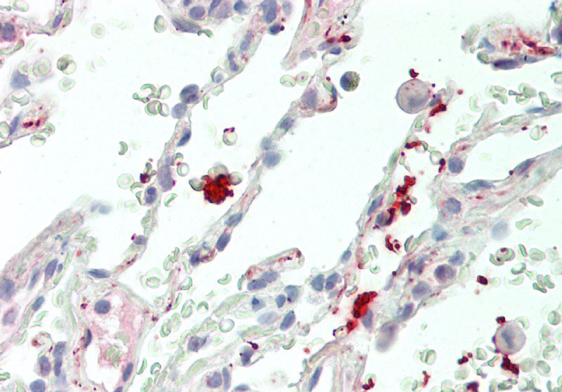 Wnt11 Antibody - middle region (ARP41258_P050) in Human Lung using Immunohistochemistry