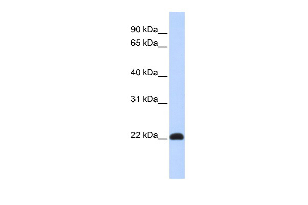 KLF16 antibody - N-terminal region (ARP39675_P050) in Human Muscle using Western Blot
