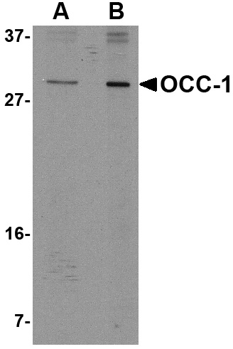 OCC-1 Antibody (OAPB00816) in 293 using Western Blot