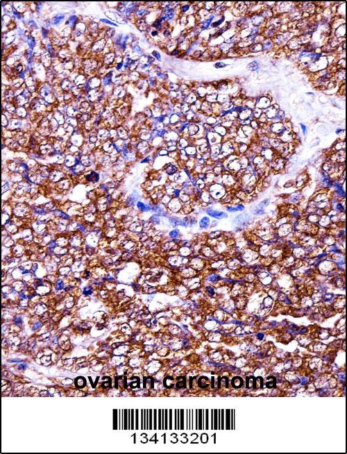 BAG2 antibody - C - terminal region (OAAB10351) in Human ovary using Immunohistochemistry