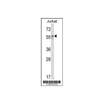 BECN1 antibody (N - terminal region (OAAB10388) in Jurkat using Western Blot