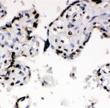 XRCC6 Polyclonal Antibody (OABB00595) in Human Placenta using Immunohistochemistry